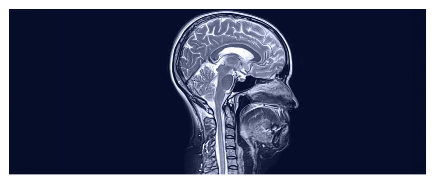 Ilustración de cabecera del artículo de Baillie Gifford: imagen tipo resonancia magnética (MRI) de un corte sagital de una cabeza humana, con el cerebro y la médula espinal en tonos azul claro sobre un fondo azul marino.