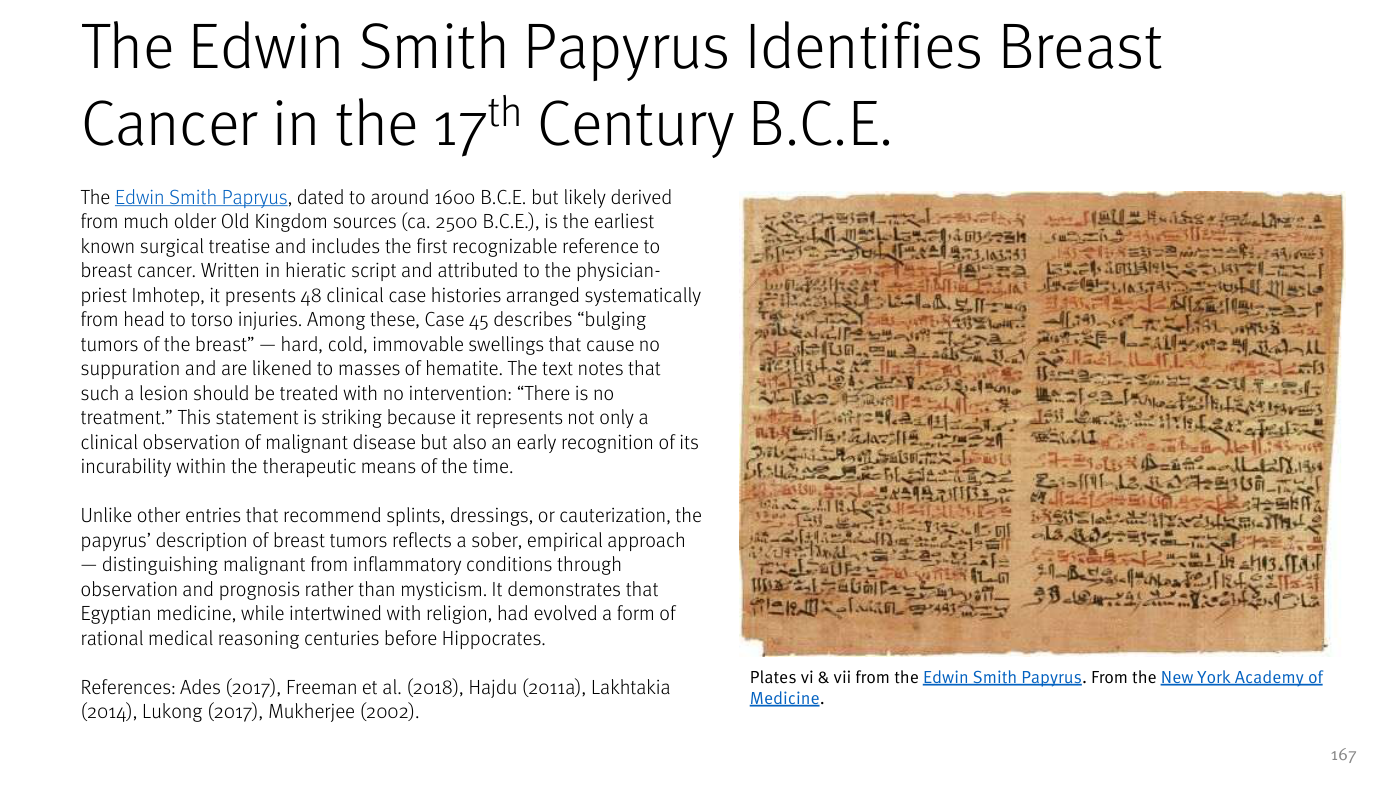 Diapositiva del informe de Stifel titulada "The Edwin Smith Papyrus Identifies Breast Cancer in the 17th Century B.C.E." Junto a un texto explicativo sobre el papiro —el primer tratado quirúrgico conocido, atribuido a Imhotep, con 48 casos clínicos— aparece a la derecha una fotografía de dos planchas (vi y vii) del propio papiro, cubiertas de escritura hierática, procedentes de la New York Academy of Medicine.