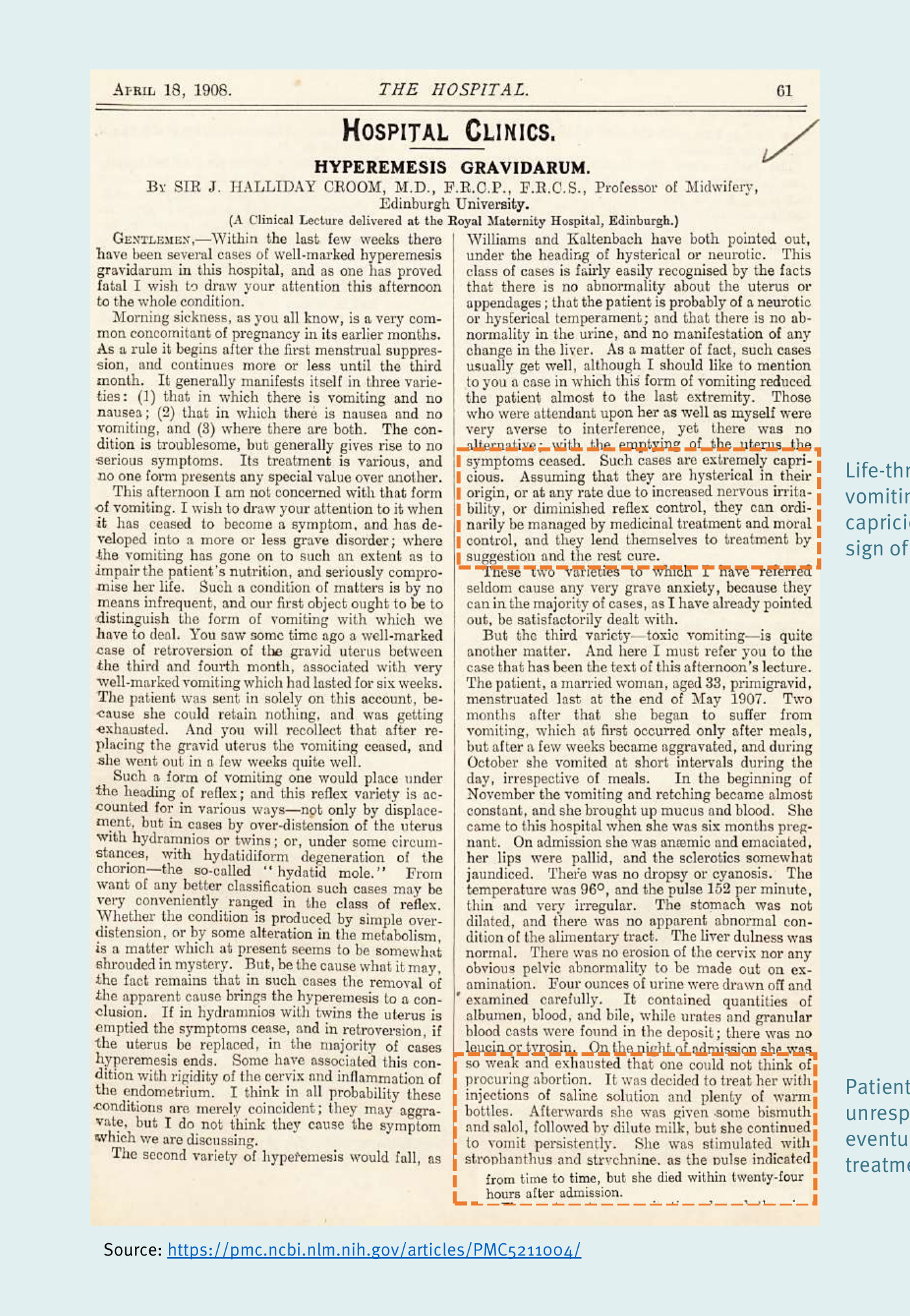 Reproducción facsímil de una página de la revista 'The Hospital' (18 de abril de 1906), titulada 'Hospital Clinics: Hyperemesis Gravidarum', impartida por Sir J. Halliday Croom en la Universidad de Edimburgo. Dos anotaciones marginales en rojo, añadidas por el autor del informe, resumen el drama clínico: 'Los vómitos potencialmente mortales se vieron como caprichosos y signo de histeria' y 'La paciente no respondió y finalmente murió en tratamiento'.